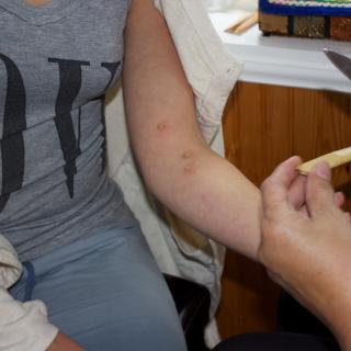 Encore: Special Targeted Treatments

