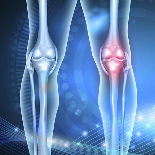 Joints - the secret to a positive outcome for joint replacement surgery
