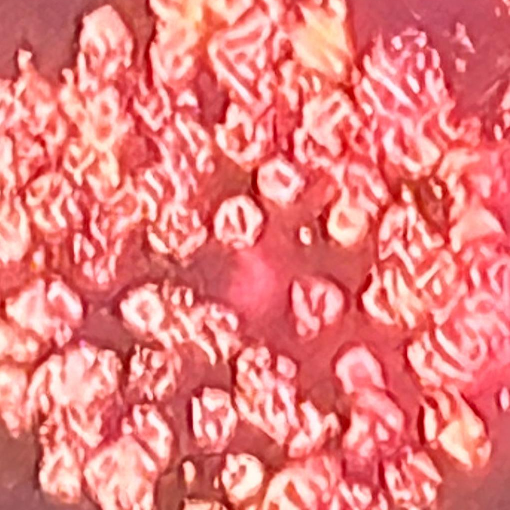 Health and Mental Equivalencies