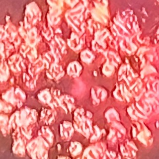 Health and Mental Equivalencies